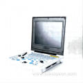 Male cirrhosis ultrasound diagnostic instrument